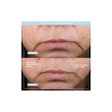 NUFACE Trinity+ Pro Smart Device Facial Toning Kit (Small Size Serums)