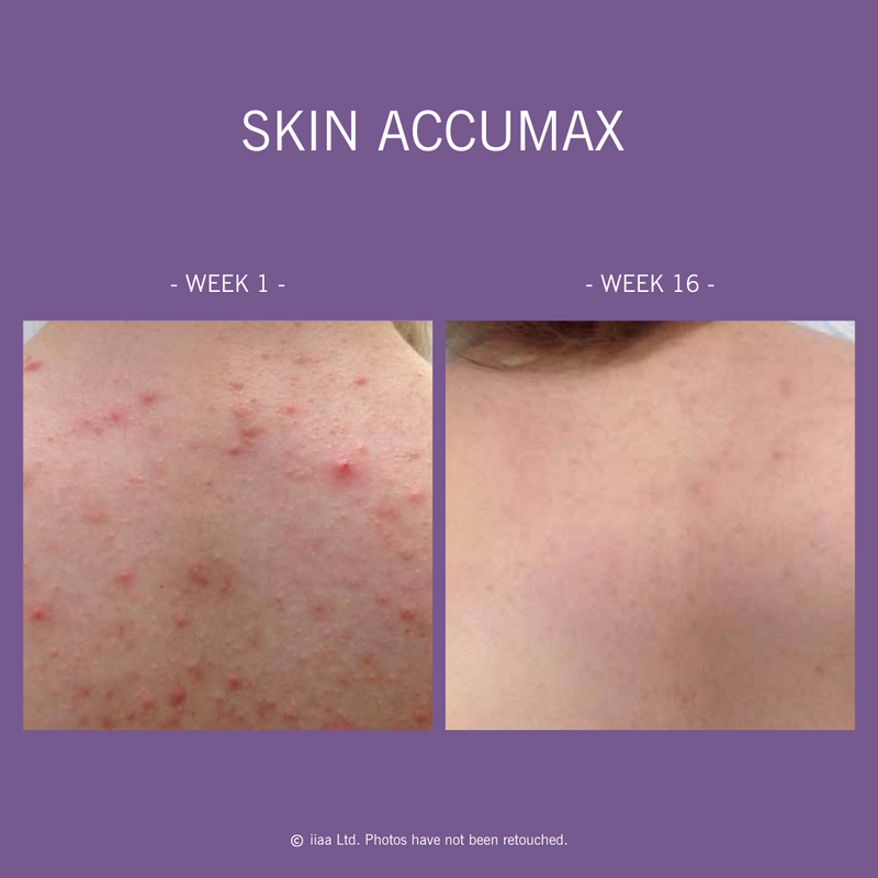 Skin Accumax 14 Week Reset Kit