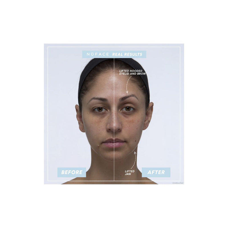 NUFACE Trinity+ Pro Smart Device Facial Toning Kit (Small Size Serums)