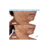 NUFACE Trinity+ Pro Smart Device Facial Toning Kit (Small Size Serums)