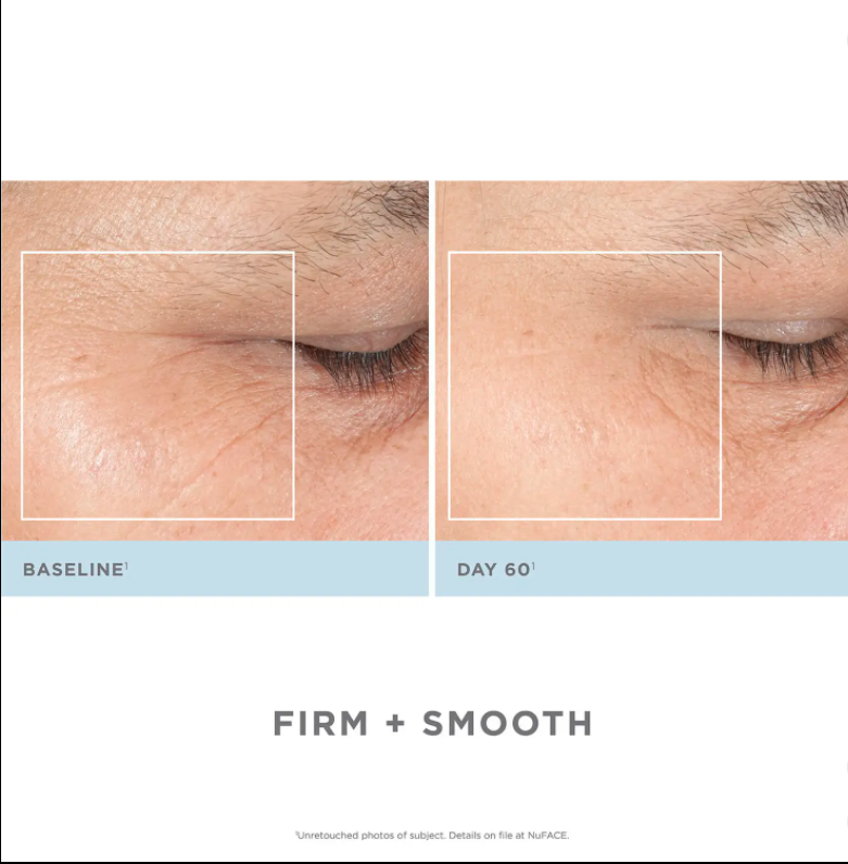NuFACE Trinity PRO + Eye and Lip Enhancer Bundle - Dermaly Shop